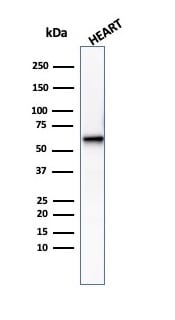 Phosphoglucomutase 5 Antibody (PGM5/3552) - Azide and BSA Free Western Blot: Phosphoglucomutase 5 Antibody (PGM5/3552) - Azide and BSA Free [NBP3-14132] -