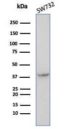 Serpin B5/Maspin Antibody (SERPINB5/4972) - Azide and BSA Free Western Blot: Serpin B5/Maspin Antibody (SERPINB5/4972) - Azide and BSA Free [NBP3-14135] -