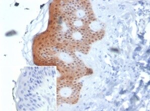 Serpin B5/Maspin Antibody (SERPINB5/4975) - Azide and BSA Free Immunohistochemistry-Paraffin: Serpin B5/Maspin Antibody (SERPINB5/4975) - Azide and BSA Free [NBP3-14136] -