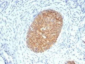 Serpin B5/Maspin Antibody (SERPINB5/4975) - Azide and BSA Free Immunohistochemistry-Paraffin: Serpin B5/Maspin Antibody (SERPINB5/4975) - Azide and BSA Free [NBP3-14136] -
