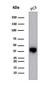 Serpin B5/Maspin Antibody (SERPINB5/4975) - Azide and BSA Free Western Blot: Serpin B5/Maspin Antibody (SERPINB5/4975) - Azide and BSA Free [NBP3-14136] -