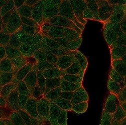 Ctip1 Antibody (PCRP-BCL11A-1H3) - Azide and BSA Free Immunocytochemistry/ Immunofluorescence: Ctip1 Antibody (PCRP-BCL11A-1H3) - Azide and BSA Free [NBP3-14141] -