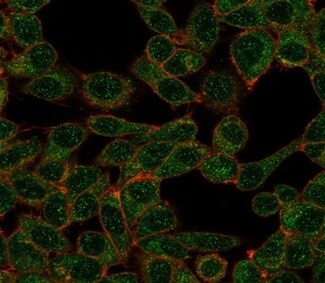 DNA Polymerase epsilon subunit 3 Antibody (PCRP-POLE3-3D3) - Azide and BSA Free Immunocytochemistry/ Immunofluorescence: DNA Polymerase epsilon subunit 3 Antibody (PCRP-POLE3-3D3) - Azide and BSA Free [NBP3-14143] -