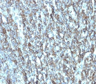 Migfilin Antibody (FBLIM1/4600) - Azide and BSA Free Immunohistochemistry-Paraffin: Migfilin Antibody (FBLIM1/4600) - Azide and BSA Free [NBP3-14149] -