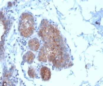 Migfilin Antibody (FBLIM1/4600) - Azide and BSA Free Immunohistochemistry-Paraffin: Migfilin Antibody (FBLIM1/4600) - Azide and BSA Free [NBP3-14149] -