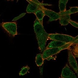 ZNF562 Antibody (PCRP-ZNF562-1A1) - Azide and BSA Free Immunocytochemistry/ Immunofluorescence: ZNF562 Antibody (PCRP-ZNF562-1A1) - Azide and BSA Free [NBP3-14150] -