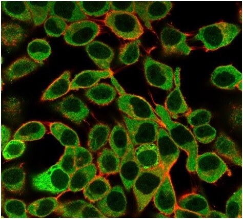 SAMD4B Antibody (PCRP-SAMD4B-1H3) - Azide and BSA Free Immunocytochemistry/ Immunofluorescence: SAMD4B Antibody (PCRP-SAMD4B-1H3) - Azide and BSA Free [NBP3-14152] -