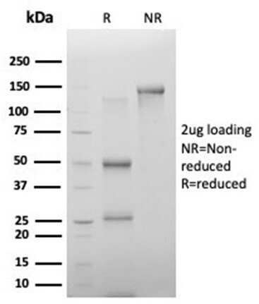PHF10 Antibody (PCRP-PHF10-2A10) - Azide and BSA Free Immunocytochemistry/ Immunofluorescence: PHF10 Antibody (PCRP-PHF10-2A10) - Azide and BSA Free [NBP3-14153] -