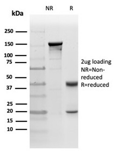 PKC iota Antibody (PRKCI/4911) - Azide and BSA Free Immunohistochemistry-Paraffin: PKC iota Antibody (PRKCI/4911) - Azide and BSA Free [NBP3-14155] -