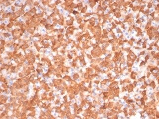 PKC iota Antibody (PRKCI/4911) - Azide and BSA Free Immunohistochemistry-Paraffin: PKC iota Antibody (PRKCI/4911) - Azide and BSA Free [NBP3-14155] -