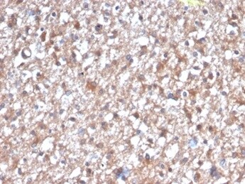 PKC iota Antibody (PRKCI/4912) - Azide and BSA Free Immunohistochemistry-Paraffin: PKC iota Antibody (PRKCI/4912) - Azide and BSA Free [NBP3-14156] -