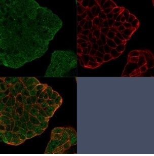 BCL-W/BCL2L2 Antibody (PCRP-BCL2L2-1A4) - Azide and BSA Free Immunocytochemistry/ Immunofluorescence: BCL-W/BCL2L2 Antibody (PCRP-BCL2L2-1A4) - Azide and BSA Free [NBP3-14166] -