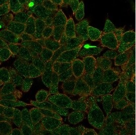 ZNF704 Antibody (PCRP-ZNF704-3C10) - Azide and BSA Free Immunocytochemistry/ Immunofluorescence: ZNF704 Antibody (PCRP-ZNF704-3C10) - Azide and BSA Free [NBP3-14168] -