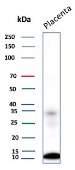 CCL8/MCP-2 Antibody (CCL8/3311) - Azide and BSA Free Western Blot: CCL8/MCP-2 Antibody (CCL8/3311) - Azide and BSA Free [NBP3-14171] -