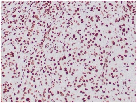 SNF5 Antibody (SMARCB1/3984) - Azide and BSA Free Immunohistochemistry-Paraffin: SNF5 Antibody (SMARCB1/3984) - Azide and BSA Free [NBP3-14177] -
