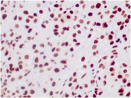 SNF5 Antibody (SMARCB1/3984) - Azide and BSA Free Immunohistochemistry-Paraffin: SNF5 Antibody (SMARCB1/3984) - Azide and BSA Free [NBP3-14177] -