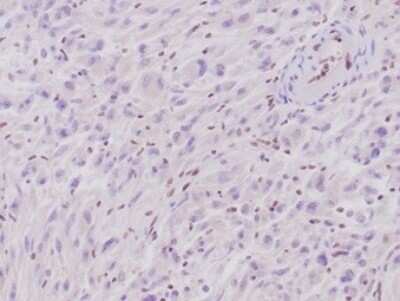 SNF5 Antibody (rSMARCB1/4588) - Azide and BSA Free Immunohistochemistry-Paraffin: SNF5 Antibody (rSMARCB1/4588) - Azide and BSA Free [NBP3-14178] -