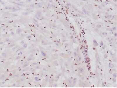 SNF5 Antibody (SMARCB1/4587R) - Azide and BSA Free Immunohistochemistry-Paraffin: SNF5 Antibody (SMARCB1/4587R) - Azide and BSA Free [NBP3-14179] -