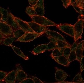 SOX4 Antibody (PCRP-SOX4-1D6) - Azide and BSA Free Immunocytochemistry/ Immunofluorescence: SOX4 Antibody (PCRP-SOX4-1D6) - Azide and BSA Free [NBP3-14180] -