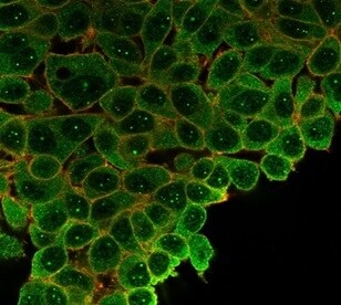 SP100 Antibody (PCRP-SP100-1B9) - Azide and BSA Free Immunocytochemistry/ Immunofluorescence: SP100 Antibody (PCRP-SP100-1B9) - Azide and BSA Free [NBP3-14183] -