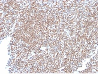 SP100 Antibody (PCRP-SP100-1B9) - Azide and BSA Free Immunohistochemistry-Paraffin: SP100 Antibody (PCRP-SP100-1B9) - Azide and BSA Free [NBP3-14183] -