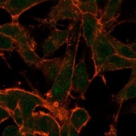 SURF5 Antibody (PCRP-MED22-2A7) - Azide and BSA Free Immunocytochemistry/ Immunofluorescence: SURF5 Antibody (PCRP-MED22-2A7) - Azide and BSA Free [NBP3-14191] -