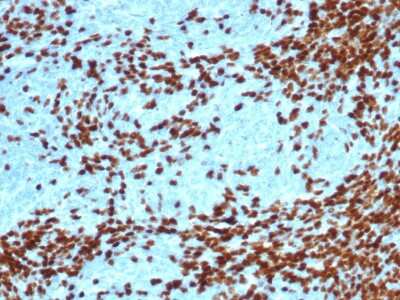 TdT Antibody (DNTT/4617R) - Azide and BSA Free Immunohistochemistry-Paraffin: TdT Antibody (DNTT/4617R) - Azide and BSA Free [NBP3-14201] -