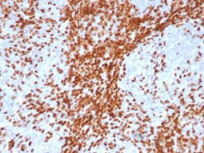 TdT Antibody (DNTT/4617R) - Azide and BSA Free Immunohistochemistry-Paraffin: TdT Antibody (DNTT/4617R) - Azide and BSA Free [NBP3-14201] -