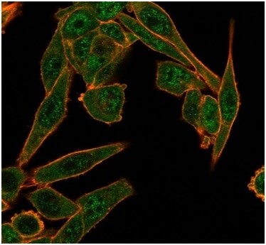 HDAC6 Antibody (PCRP-HDAC6-1A4) - Azide and BSA Free Immunocytochemistry/ Immunofluorescence: HDAC6 Antibody (PCRP-HDAC6-1A4) - Azide and BSA Free [NBP3-14206] -