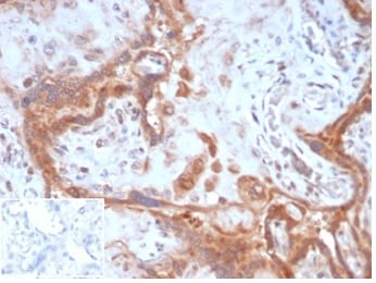 Fibroblast Activation Protein alpha/FAP Antibody (FAP/4851) - Azide and BSA Free Immunohistochemistry-Paraffin: Fibroblast Activation Protein alpha/FAP Antibody (FAP/4851) - Azide and BSA Free [NBP3-14219] -
