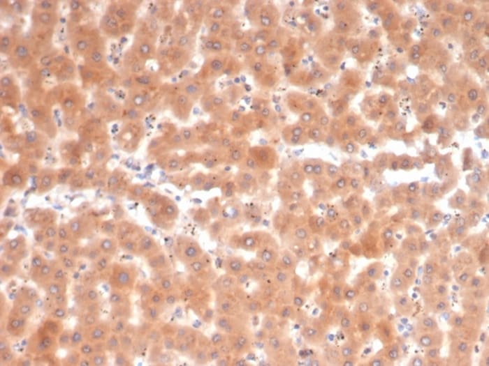 Fibroblast Activation Protein alpha/FAP Antibody (FAP/4853) - Azide and BSA Free Immunohistochemistry-Paraffin: Fibroblast Activation Protein alpha/FAP Antibody (FAP/4853) - Azide and BSA Free [NBP3-14220] -