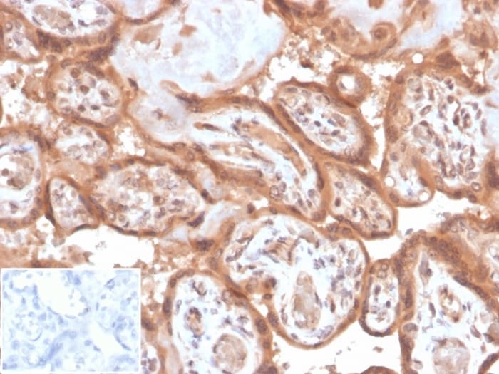 Fibroblast Activation Protein alpha/FAP Antibody (FAP/4853) - Azide and BSA Free Immunohistochemistry-Paraffin: Fibroblast Activation Protein alpha/FAP Antibody (FAP/4853) - Azide and BSA Free [NBP3-14220] -