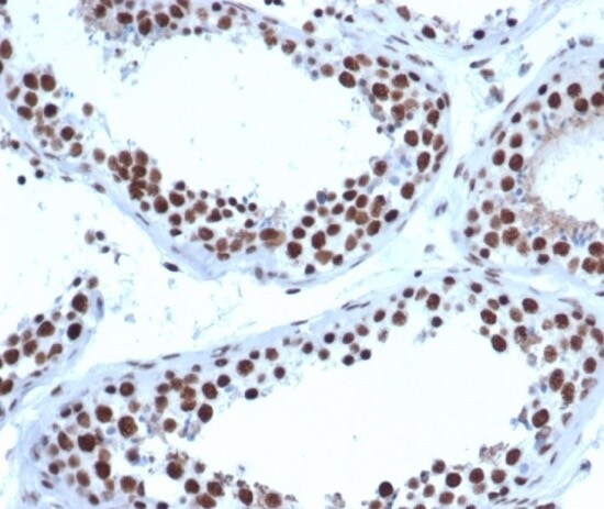 JAZF1 Antibody (PCRP-JAZF1-1C2) - Azide and BSA Free Immunohistochemistry-Paraffin: JAZF1 Antibody (PCRP-JAZF1-1C2) - Azide and BSA Free [NBP3-14221] -
