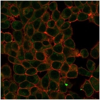 HIC2 Antibody (PCRP-HIC2-1B1) - Azide and BSA Free Immunocytochemistry/ Immunofluorescence: HIC2 Antibody (PCRP-HIC2-1B1) - Azide and BSA Free [NBP3-14231] -
