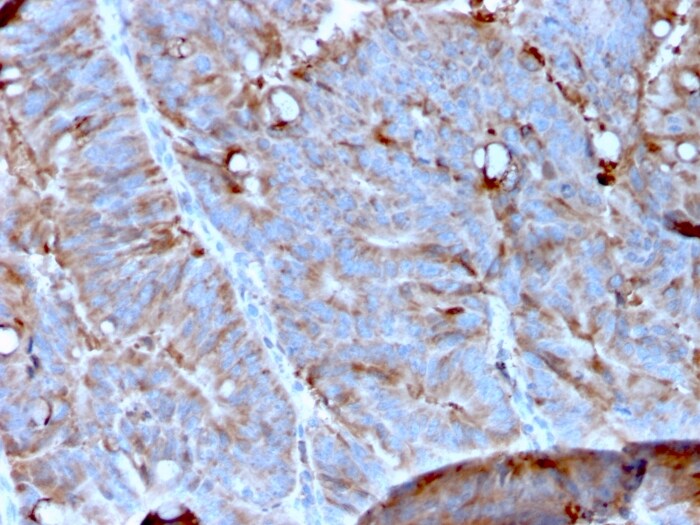 Mer Antibody (MERTK/3023) - Azide and BSA Free Immunohistochemistry-Paraffin: Mer Antibody (MERTK/3023) - Azide and BSA Free [NBP3-14234] -