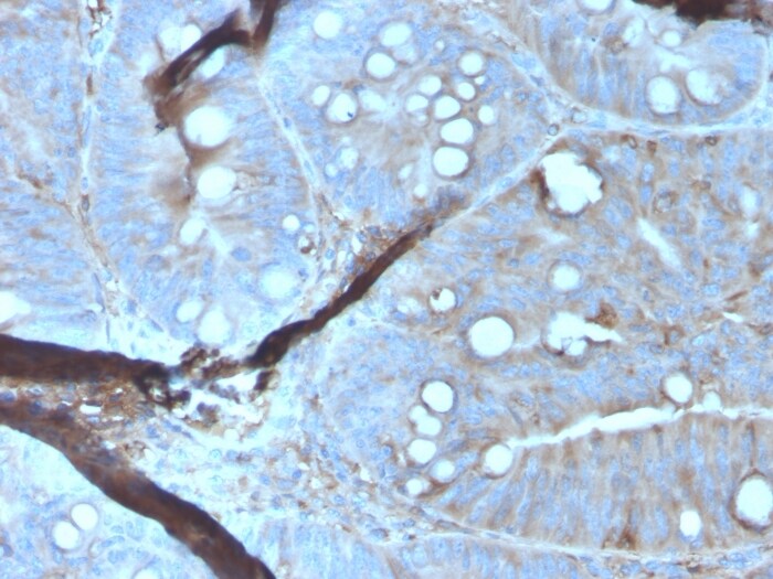 Mer Antibody (MERTK/3023) - Azide and BSA Free Immunohistochemistry-Paraffin: Mer Antibody (MERTK/3023) - Azide and BSA Free [NBP3-14234] -
