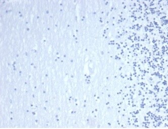 GATA-3 Antibody (GATA3/4550R) - Azide and BSA Free Immunohistochemistry-Paraffin: GATA-3 Antibody (GATA3/4550R) - Azide and BSA Free [NBP3-14267] -