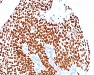 GATA-3 Antibody (GATA3/4550R) - Azide and BSA Free Immunohistochemistry-Paraffin: GATA-3 Antibody (GATA3/4550R) - Azide and BSA Free [NBP3-14267] -