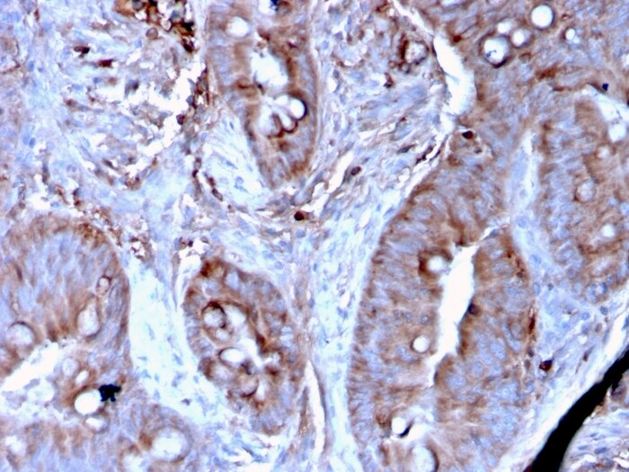Mer Antibody (MERTK/3024) - Azide and BSA Free Immunohistochemistry-Paraffin: Mer Antibody (MERTK/3024) - Azide and BSA Free [NBP3-14269] -