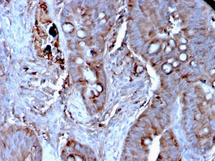 Mer Antibody (MERTK/3024) - Azide and BSA Free Immunohistochemistry-Paraffin: Mer Antibody (MERTK/3024) - Azide and BSA Free [NBP3-14269] -