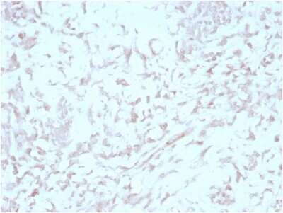 MIG2/Kindlin-2 Antibody (3A3) - Azide and BSA Free Immunohistochemistry-Paraffin: MIG2/Kindlin-2 Antibody (3A3) - Azide and BSA Free [NBP3-14275] -