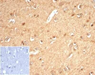 AKR1B1 Antibody (AKR1B1/7010R) - Azide and BSA Free Immunohistochemistry-Paraffin: AKR1B1 Antibody (AKR1B1/7010R) - Azide and BSA Free [NBP3-14284] -