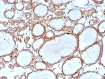 RHOBTB2 Antibody (DBC2/3361) - Azide and BSA Free Immunohistochemistry-Paraffin: RHOBTB2 Antibody (DBC2/3361) - Azide and BSA Free [NBP3-14286] -