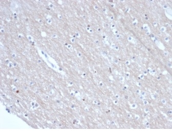 SATB2 Antibody (rSATB2/6929) - Azide and BSA Free