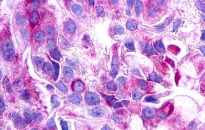 Galanin R3/GALR3 Antibody