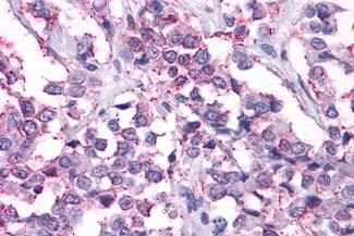 NPY2R Antibody