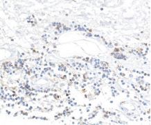 CD96 Antibody (BLR065G)