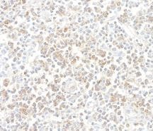 CD96 Antibody (BLR065G)