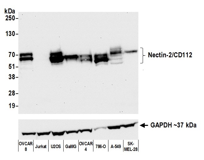 Nectin-2/CD112 Antibody (BLR071G)