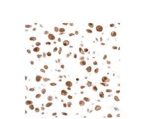 STAT3 Antibody (BLR098G)